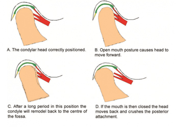 Dr. David - Bolton, MA Dentist - Jaw Joint Function