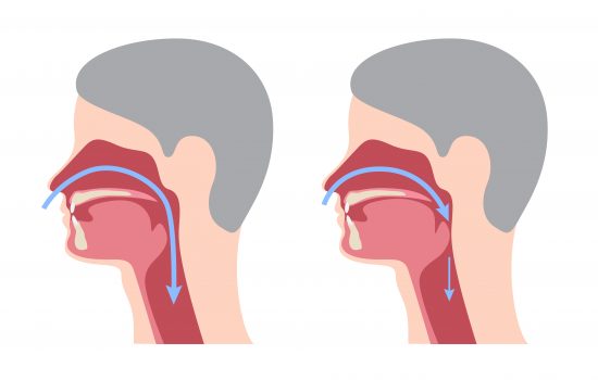 Common questions about sleep apnea