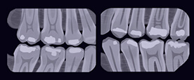 Cone beam radiograph