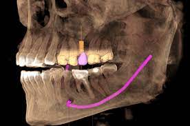 Cone beam radiograph