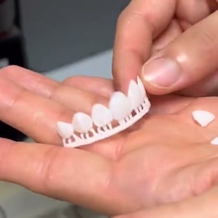 Dr. David - Bolton, MA Dentist - 3D Printed Dental Veneers